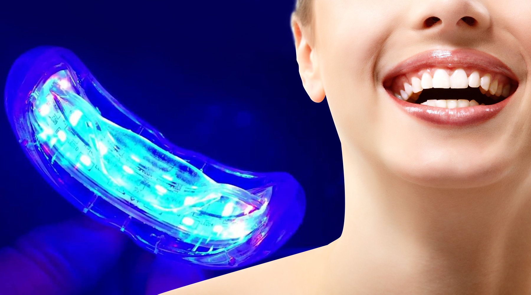 Implantsmile dentis лед. Primal Life Teeth Whitening. Radiation Ultraviolet Dentistry. Teeth Whitening Mr Coco.